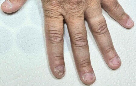 Professionelle Hand- und Nagelpflege La Bellaposa Schmitten