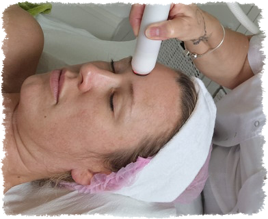 Behandlug coldplasma von La Bellaposa Professionelles coldplasma La Bellaposa Schmitten
